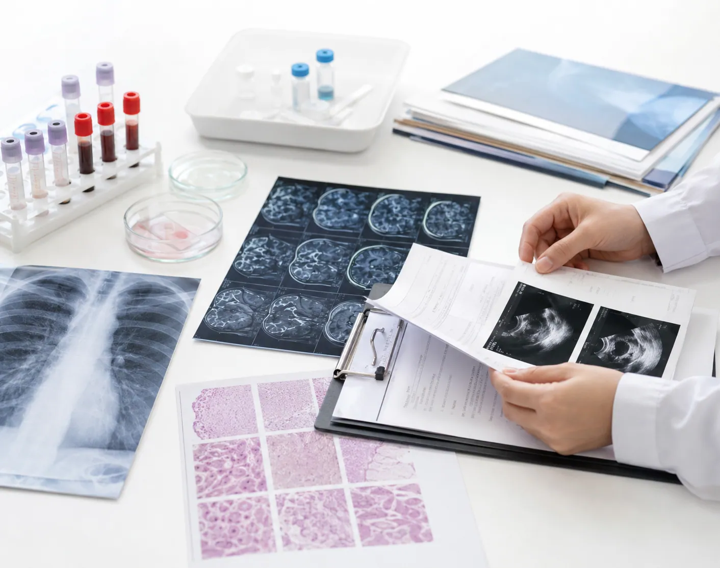 Medical scans laboratory results and treatment history prepared for an allogeneic stem cell evidence review