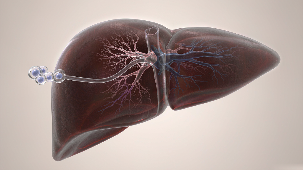 Semi-transparent whole liver in three-quarter view revealing the branching portal and hepatic vein trees inside, with a fine infusion line entering the portal vein at the left